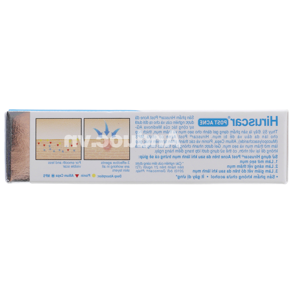 Gel Hiruscar Post Acne làm mờ sẹo mụn & thâm mụn tuýp 5g