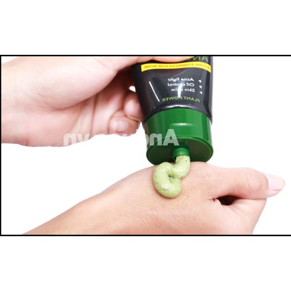 Kem rửa mặt Oxy Total Anti-Acne trà xanh làm dịu da, kiểm soát nhờn tuýp 100g